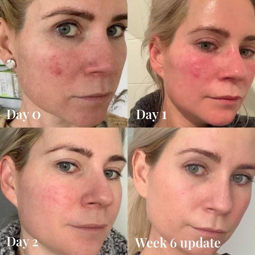 Omnilux Contour Face-Skin Care Tools-Omnilux-Leigh Kelley Skin Studio Best Facialist Hudson Valley Kingston New York