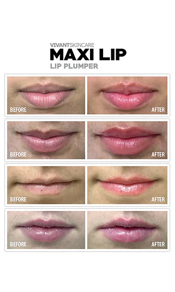 Vivant Maxilip Lip Plumper