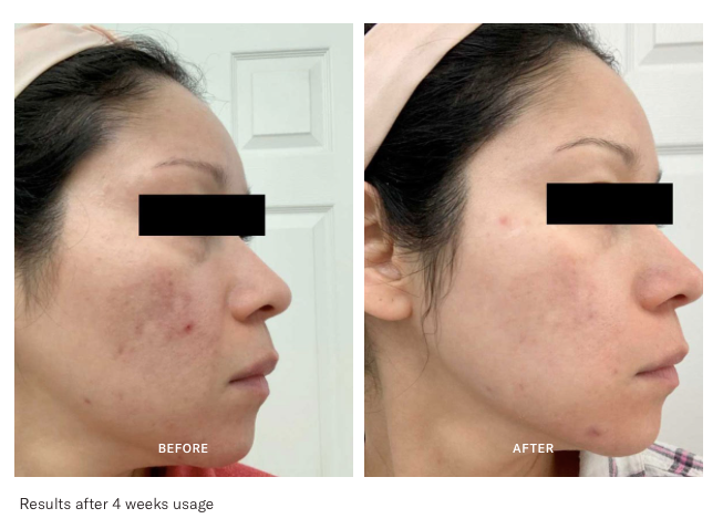 Calcium Professional Pigment Solution