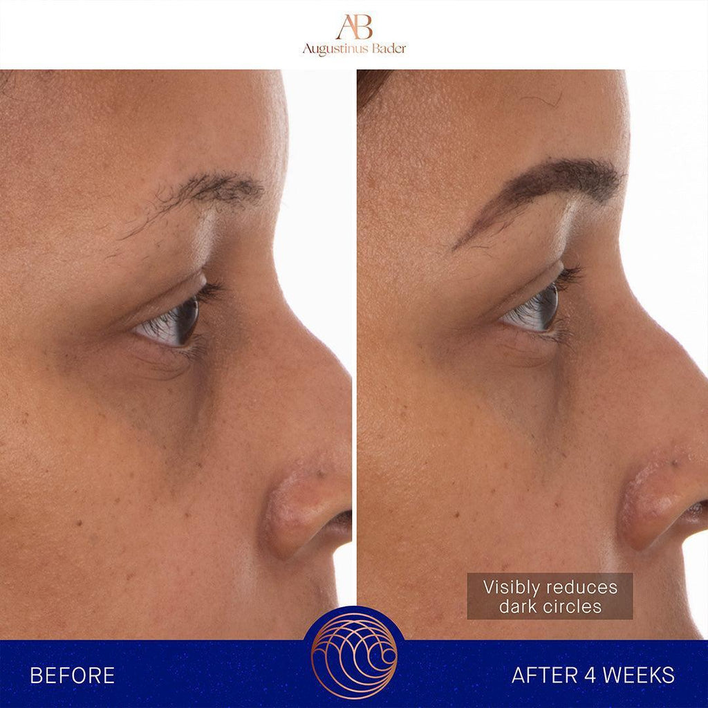 Augustinus Bader The Eye Patches-Eye Masks-Augustinus Bader-Leigh Kelley Skin Studio Best Facialist Hudson Valley Kingston New York