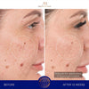 Augustinus Bader The Retinol Serum-Serum-Augustinus Bader-Leigh Kelley Skin Studio Best Facialist Hudson Valley Kingston New York