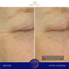 Augustinus Bader The Ultimate Soothing Cream-Lotion & Moisturizer-Augustinus Bader-Leigh Kelley Skin Studio Best Facialist Hudson Valley Kingston New York