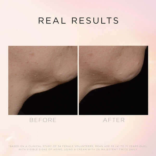 COSMEDIX Illuminate & Lift Neck & Décolleté Treatment-Lotion & Moisturizer-CosMedix-Leigh Kelley Skin Studio Best Facialist Hudson Valley Kingston New York