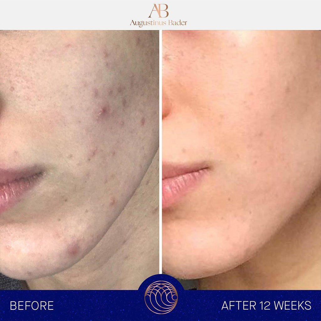 Augustinus Bader The Cream-Lotion & Moisturizer-Augustinus Bader-Leigh Kelley Skin Studio Best Facialist Hudson Valley Kingston New York