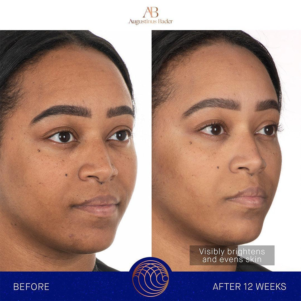 Augustinus Bader The Face Cream Mask-Masks & Treatments-Augustinus Bader-Leigh Kelley Skin Studio Best Facialist Hudson Valley Kingston New York