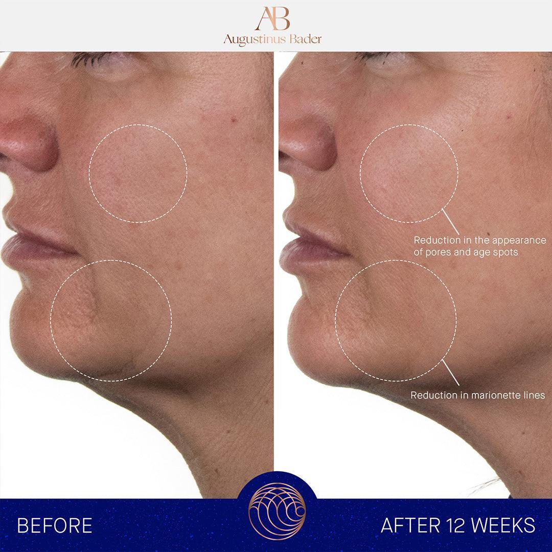 Augustinus Bader The Rich Cream-Lotion & Moisturizer-Augustinus Bader-Leigh Kelley Skin Studio Best Facialist Hudson Valley Kingston New York