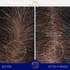 augustinus bader the conditioner before and after scalp pictures