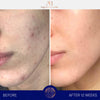 augustinus bader the cream before and after skin close up