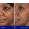 augustinus bader the face cream mask before and after results
