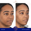 augustinus bader the face cream mask before and after results of face