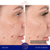 augustinus bader the retinol serum before and after close up