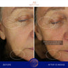 augustinus bader the ultimate soothing cream before and after results