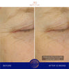 augustinus bader the ultimate soothing cream before and after eye results
