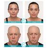 before and after results of Epicuren Skin Brightening Serum