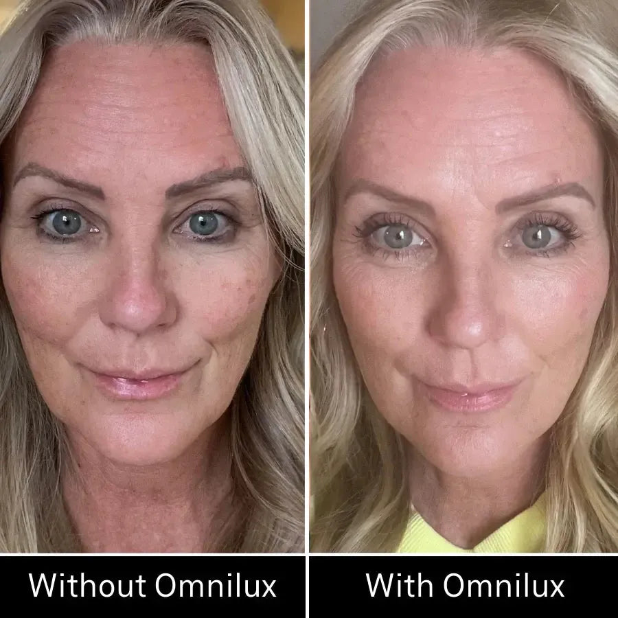 Omnilux Contour Face-Skin Care Tools-Omnilux-Leigh Kelley Skin Studio Best Facialist Hudson Valley Kingston New York