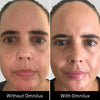 Omnilux Contour Face-Skin Care Tools-Omnilux-Leigh Kelley Skin Studio Best Facialist Hudson Valley Kingston New York