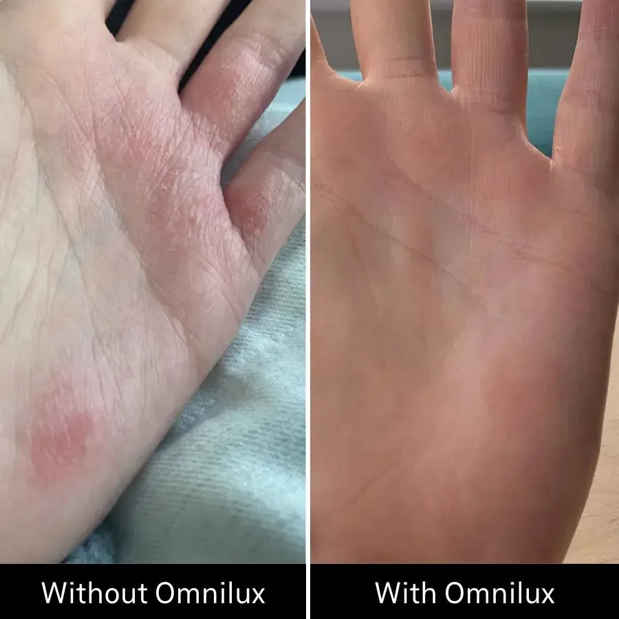 Omnilux Contour Glove-Skin Care Tools-Omnilux-Leigh Kelley Skin Studio Best Facialist Hudson Valley Kingston New York