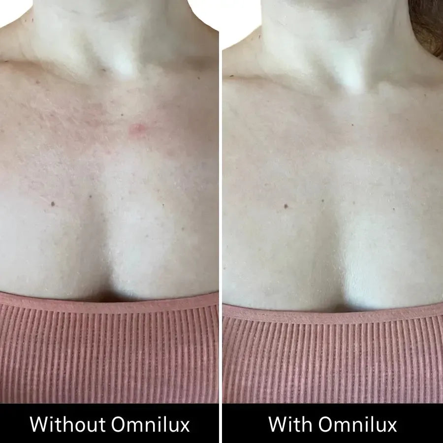 Omnilux Contour Neck & Décolleté-Skin Care Tools-Omnilux-Leigh Kelley Skin Studio Best Facialist Hudson Valley Kingston New York