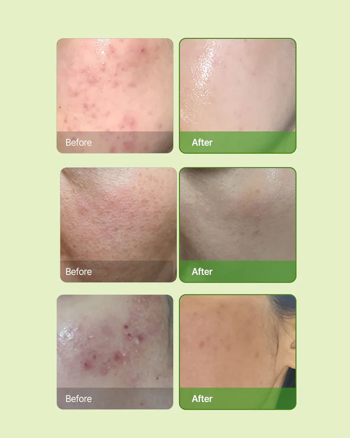 OxygenCeuticals Skin Barrier Ato Cream-Lotion & Moisturizer-OxygenCeuticals-Leigh Kelley Skin Studio