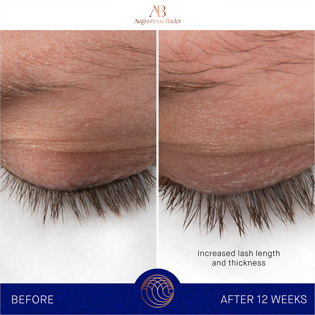 augustinus bader the lash eyebrow enhancing serum before and after results