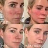 Omnilux Contour Face-Skin Care Tools-Omnilux-Leigh Kelley Skin Studio Best Facialist Hudson Valley Kingston New York